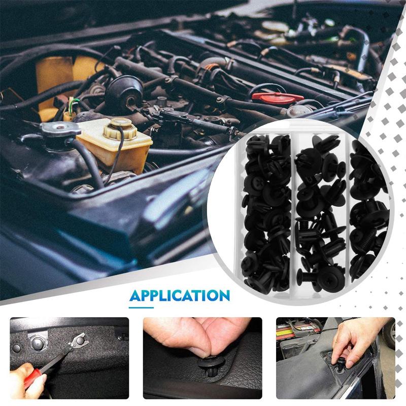 Clips de fixation universels en plastique pour garde-boue de voiture (150 pièces)