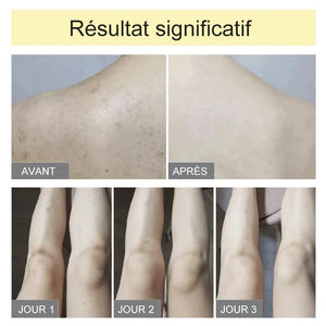 Eponge Exfoliante Ultra Douce