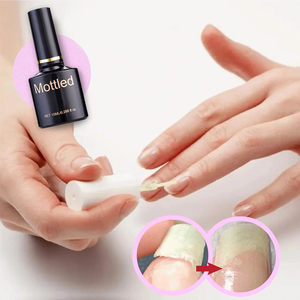 Gel De Protection Des Ongles
